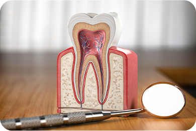 診療案内_根管治療