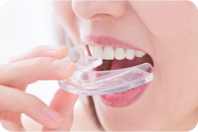 診療案内_マウスピース製作